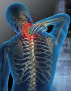El dolor intercostal